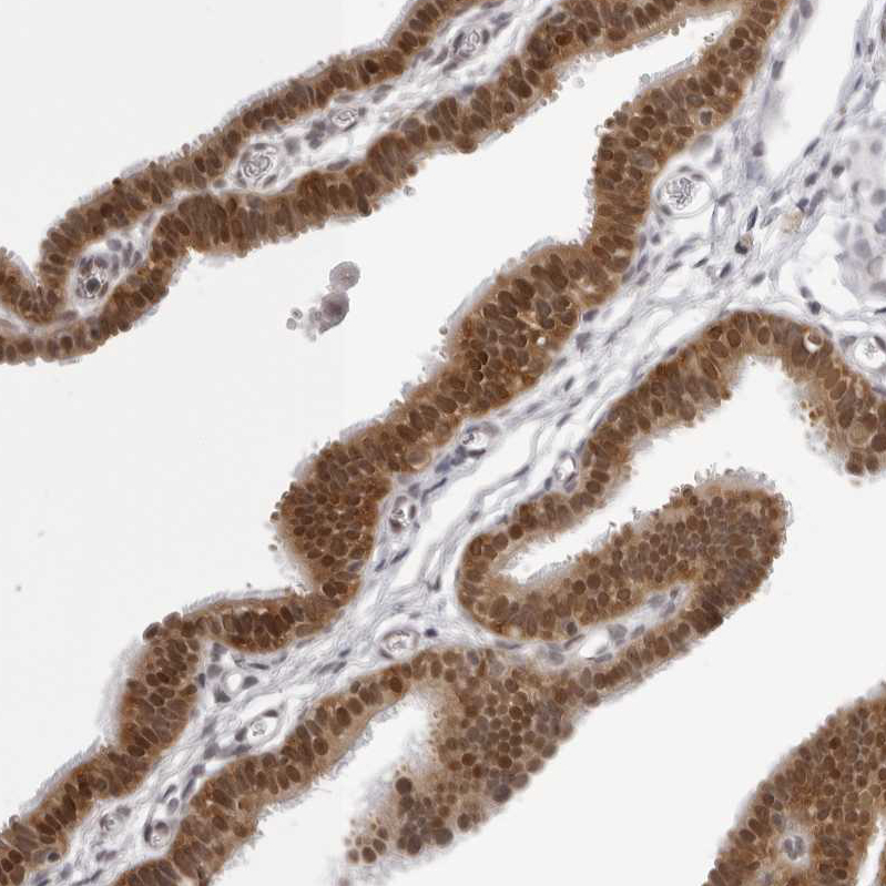Atlas Antibodies Anti-WDR77 Antibody