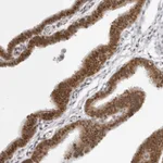 Atlas Antibodies Anti-WDR77 Antibody