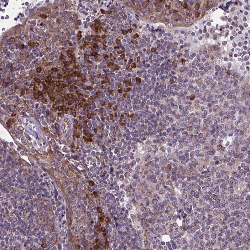 Atlas Antibodies Anti-WDR83OS Antibody