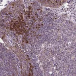 Atlas Antibodies Anti-WDR83OS Antibody