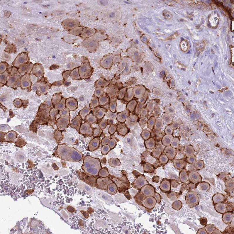 Atlas Antibodies Anti-WDR90 Antibody