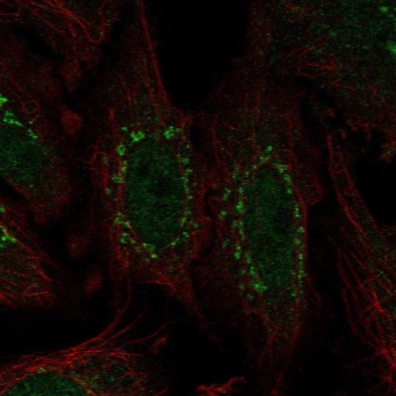 Atlas Antibodies Anti-WDR88 Antibody