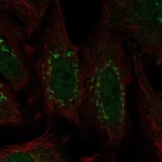 Atlas Antibodies Anti-WDR88 Antibody