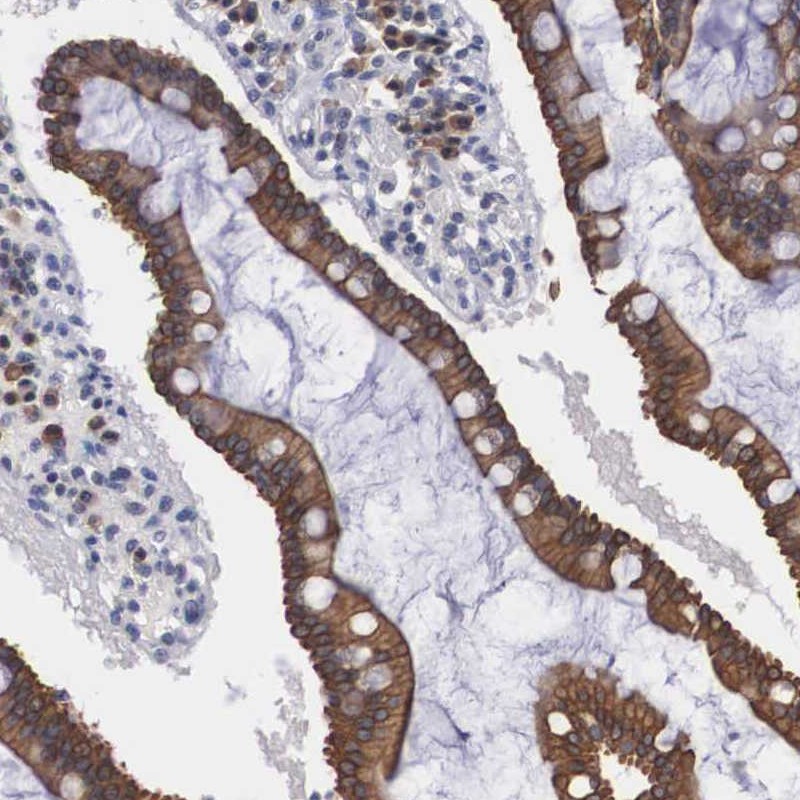 Atlas Antibodies Anti-WDR89 Antibody