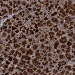 Atlas Antibodies Anti-WDR88 Antibody