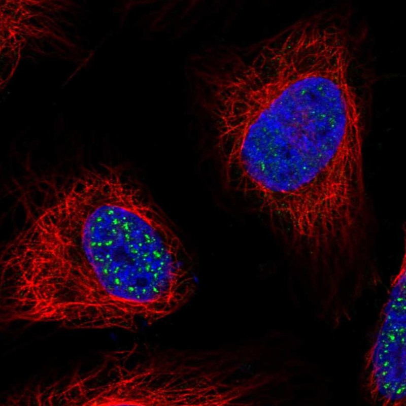 Atlas Antibodies Anti-WDR90 Antibody