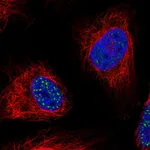 Atlas Antibodies Anti-WDR90 Antibody
