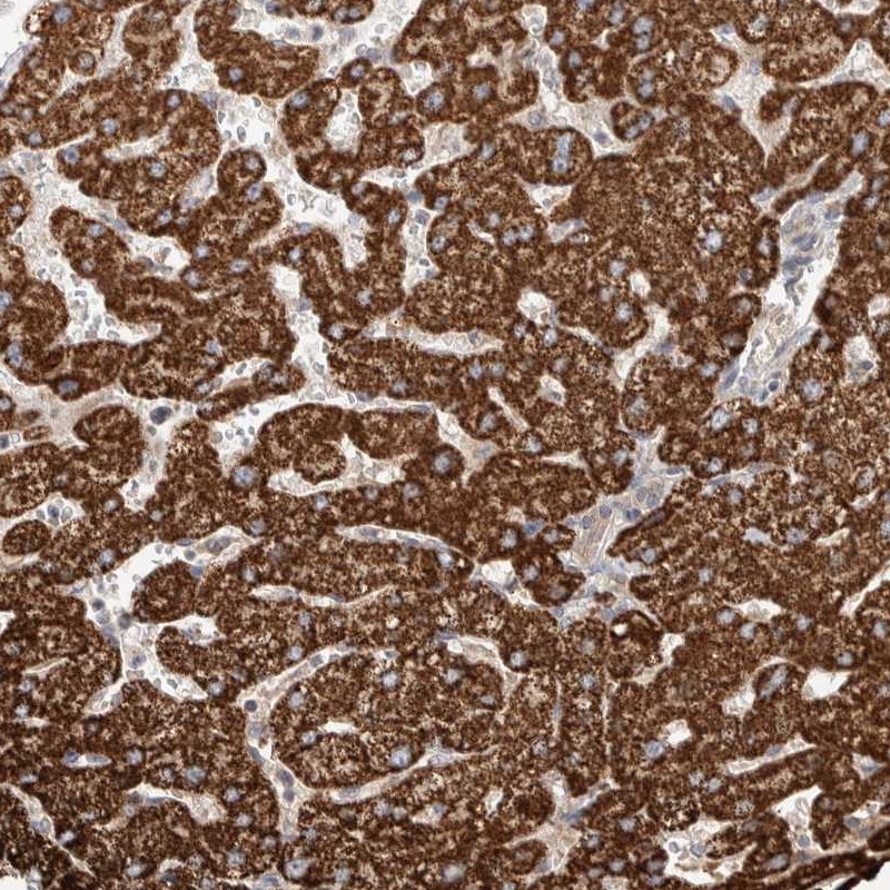 Atlas Antibodies Anti-WDR91 Antibody