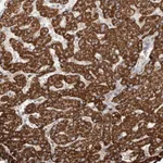 Atlas Antibodies Anti-WDR91 Antibody