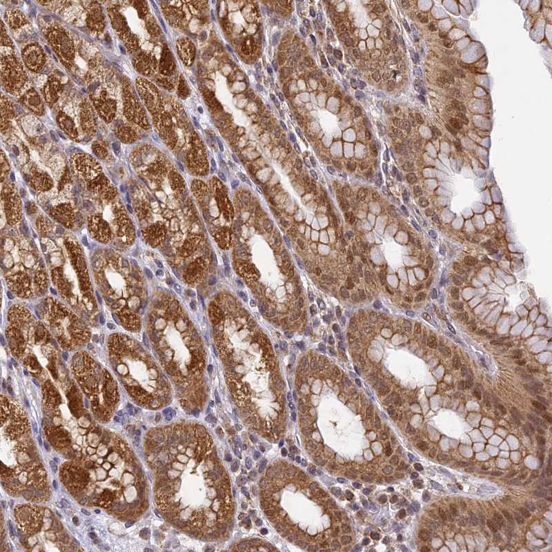 Atlas Antibodies Anti-WDR92 Antibody