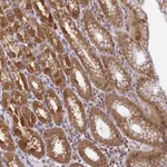 Atlas Antibodies Anti-WDR92 Antibody