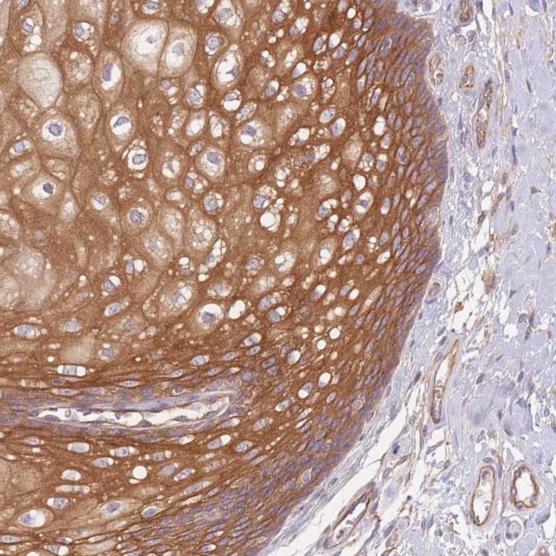 Atlas Antibodies Anti-WDR93 Antibody