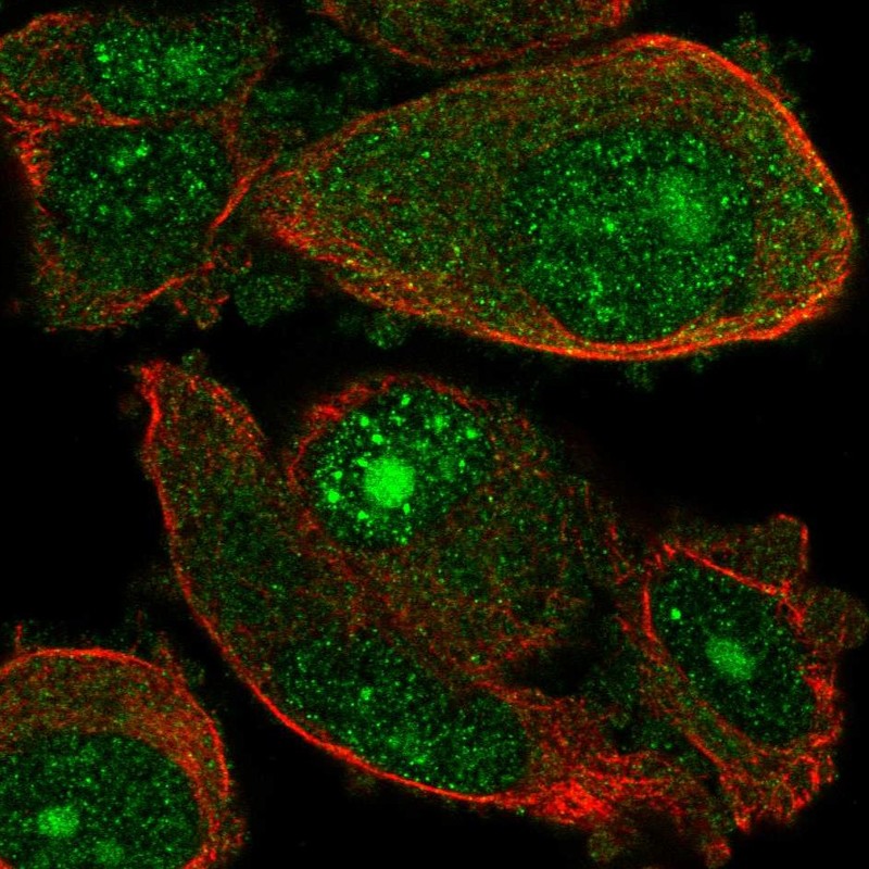 Atlas Antibodies Anti-WDSUB1 Antibody