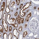 Atlas Antibodies Anti-WDSUB1 Antibody
