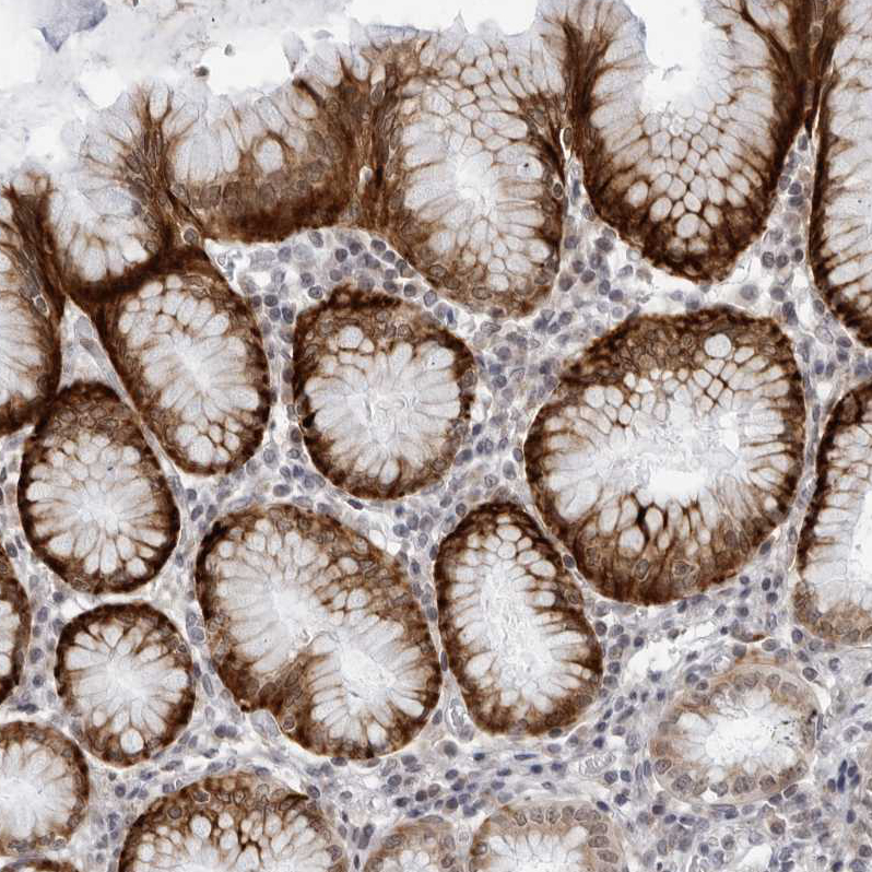 Atlas Antibodies Anti-WDTC1 Antibody