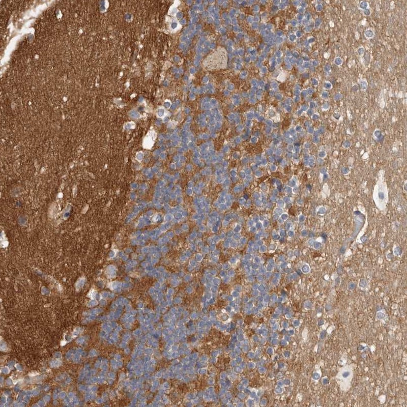 Atlas Antibodies Anti-WDTC1 Antibody