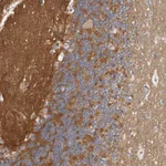 Atlas Antibodies Anti-WDTC1 Antibody