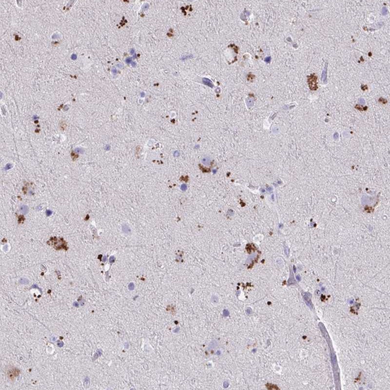 Atlas Antibodies Anti-WDR97 Antibody