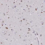Atlas Antibodies Anti-WDR97 Antibody