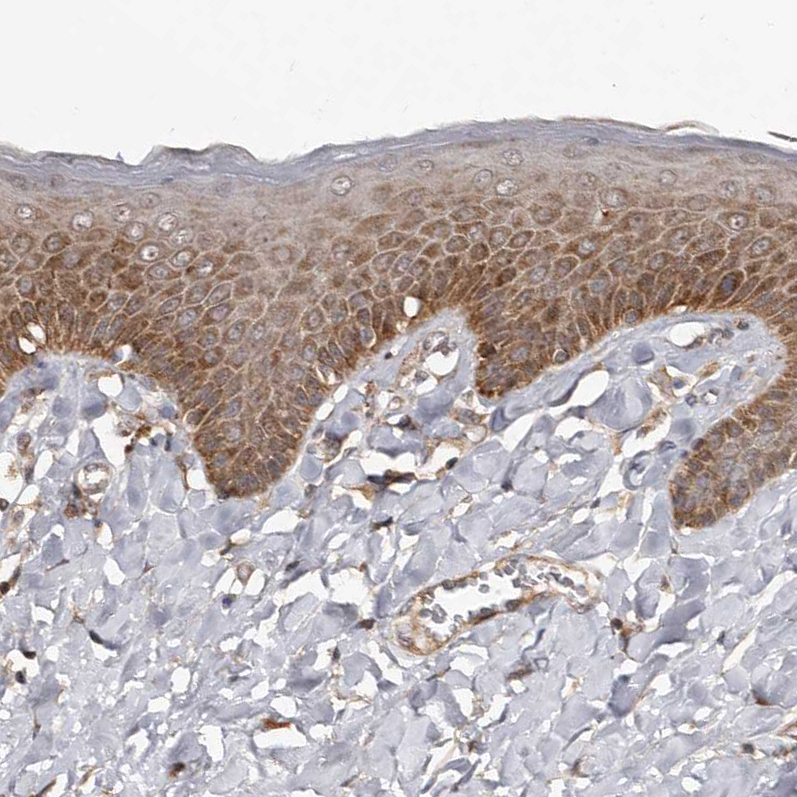 Atlas Antibodies Anti-WEE2 Antibody