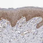 Atlas Antibodies Anti-WEE2 Antibody