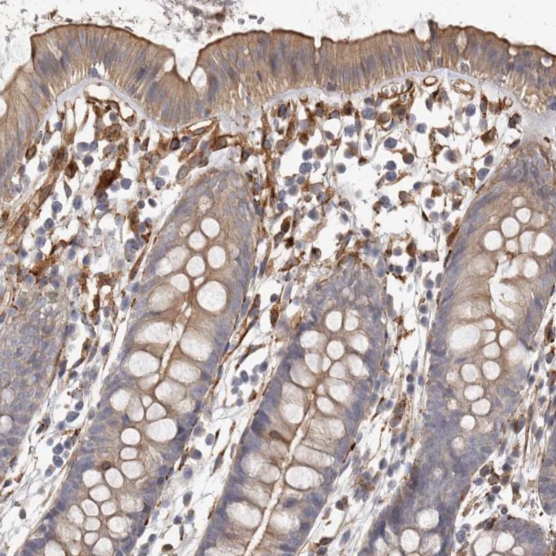 Atlas Antibodies Anti-WDTC1 Antibody