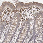Atlas Antibodies Anti-WDTC1 Antibody
