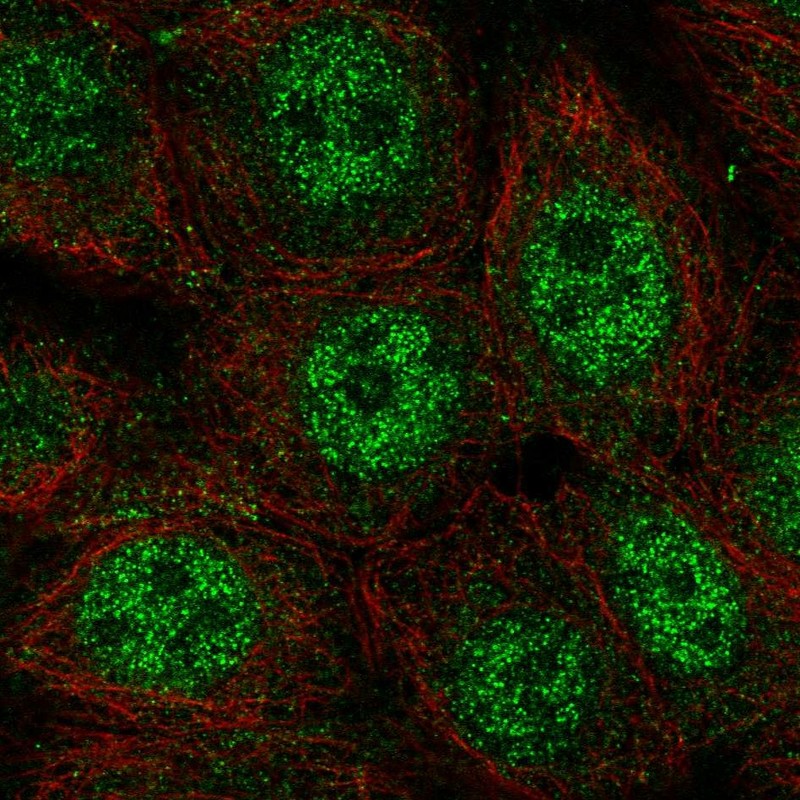 Atlas Antibodies Anti-WDYHV1 Antibody