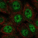 Atlas Antibodies Anti-WDYHV1 Antibody