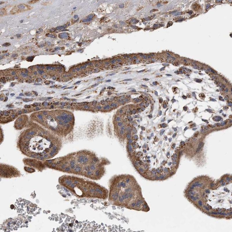 Atlas Antibodies Anti-WFDC1 Antibody