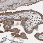 Atlas Antibodies Anti-WFDC1 Antibody