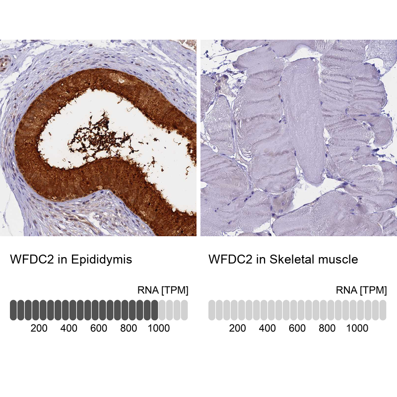 Atlas Antibodies Anti-WFDC2 Antibody