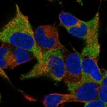 Atlas Antibodies Anti-WIPF1 Antibody