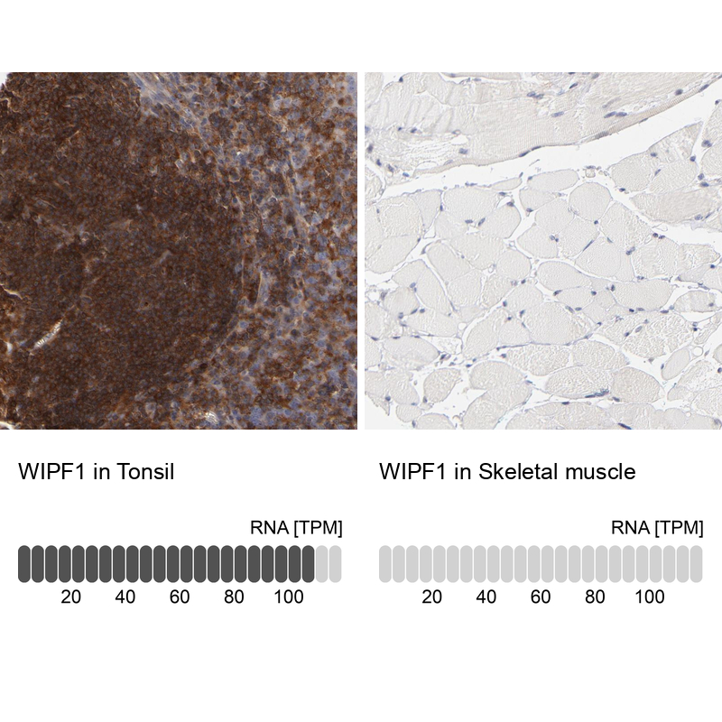Atlas Antibodies Anti-WIPF1 Antibody