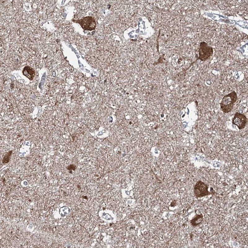 Atlas Antibodies Anti-WHAMM Antibody