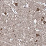 Atlas Antibodies Anti-WHAMM Antibody