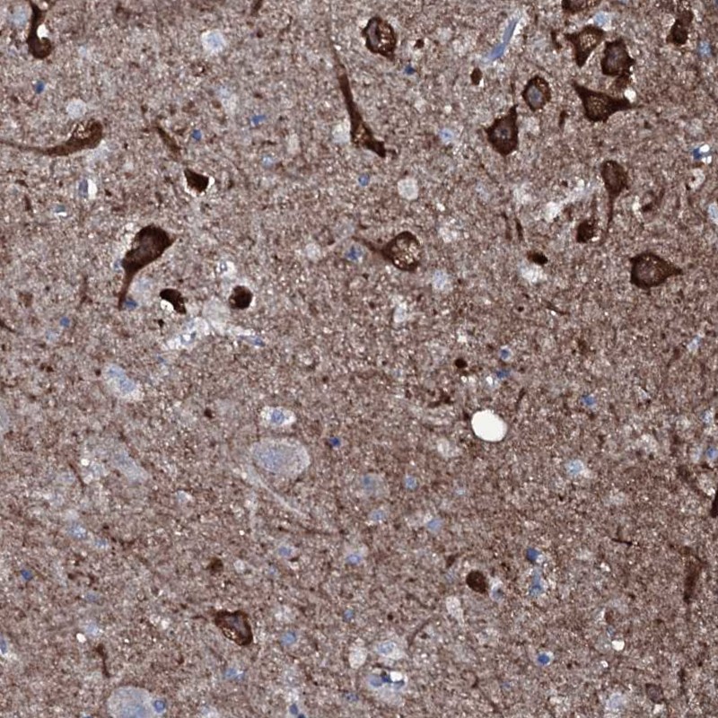 Atlas Antibodies Anti-WIPF3 Antibody