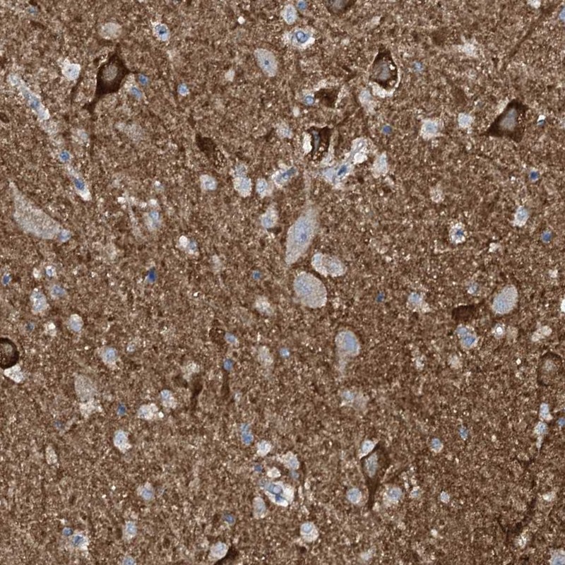Atlas Antibodies Anti-WIPF3 Antibody