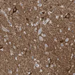 Atlas Antibodies Anti-WIPF3 Antibody