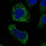 Atlas Antibodies Anti-WISP3 Antibody