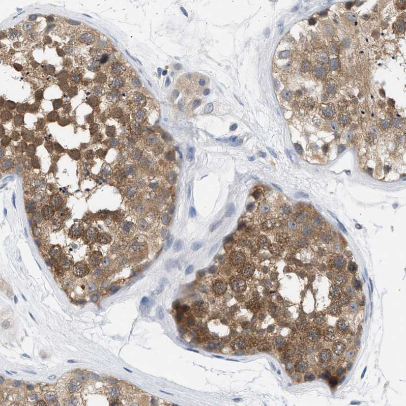 Atlas Antibodies Anti-WIPI2 Antibody