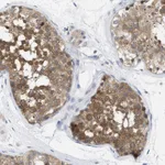 Atlas Antibodies Anti-WIPI2 Antibody