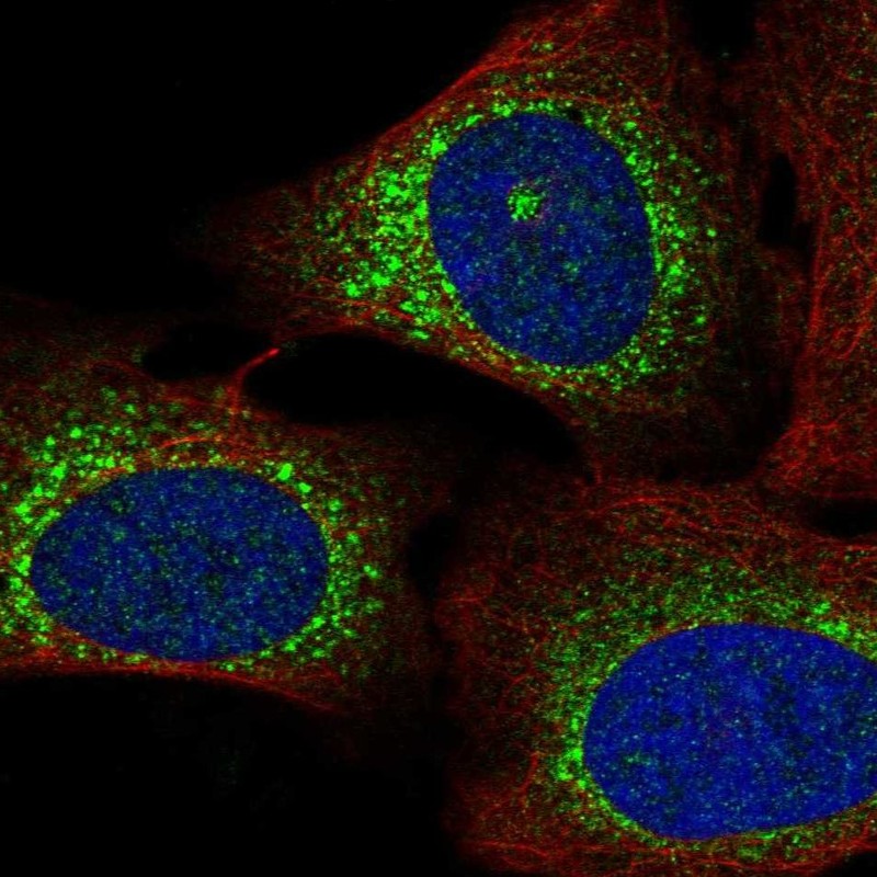 Atlas Antibodies Anti-WISP3 Antibody