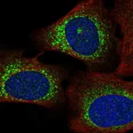 Atlas Antibodies Anti-WISP3 Antibody