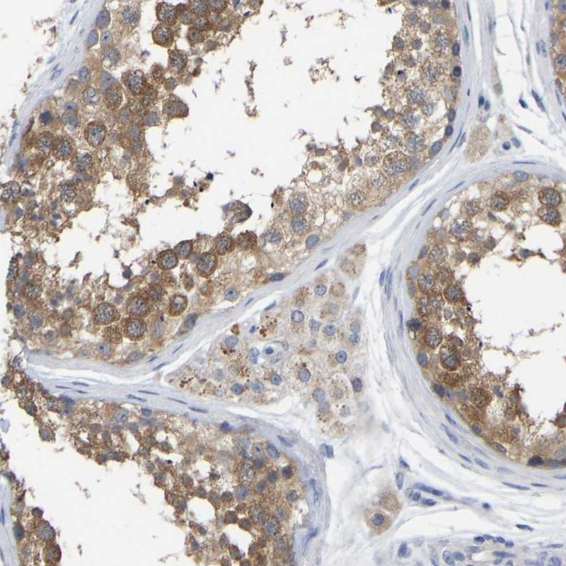 Atlas Antibodies Anti-WIPI2 Antibody