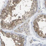 Atlas Antibodies Anti-WIPI2 Antibody