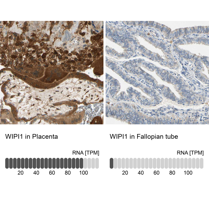 Atlas Antibodies Anti-WIPI1 Antibody