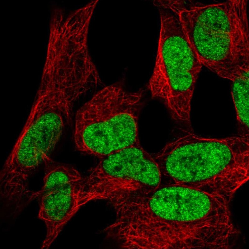 Atlas Antibodies Anti-WIZ Antibody