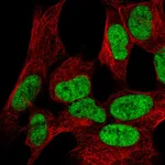 Atlas Antibodies Anti-WIZ Antibody