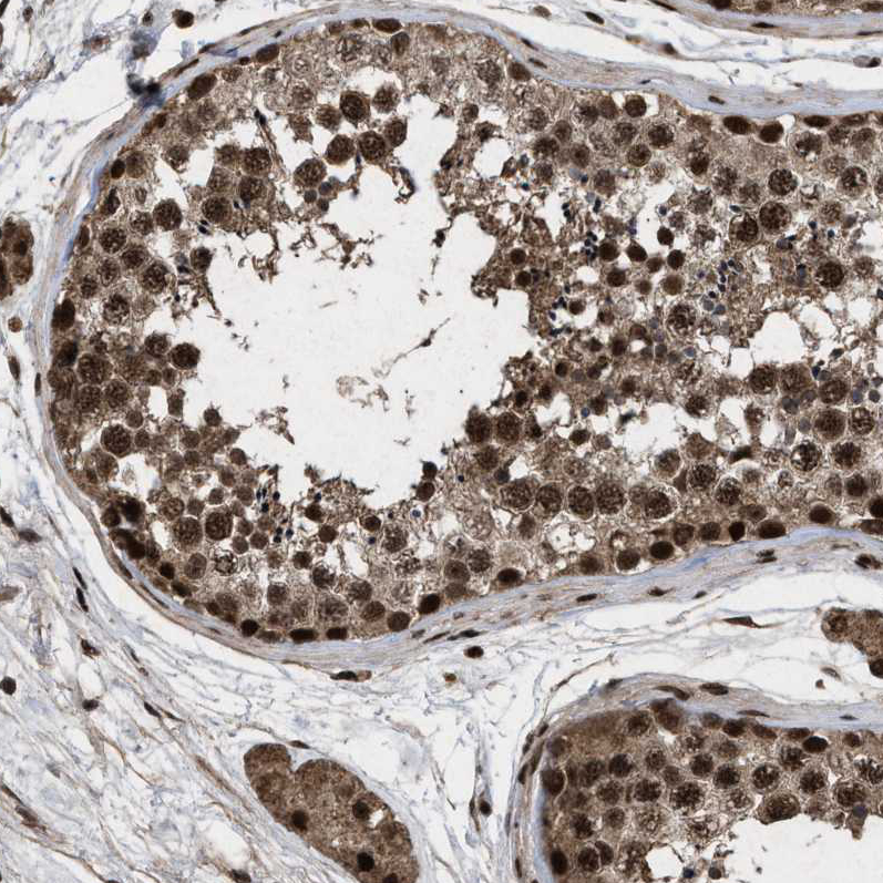 Atlas Antibodies Anti-WIZ Antibody